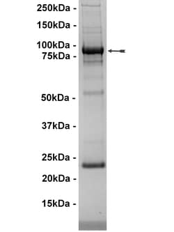Eurofins DiscoverX Flt1 Protein, Active 10 &mu;g | Buy Online | Eurofins DiscoverX | Fisher Scientific